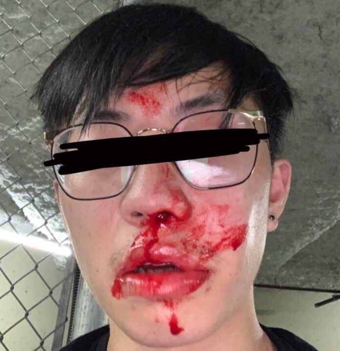 A Vancouver man is left bloodied and with a concussion after a confrontation with a Canadian border officer