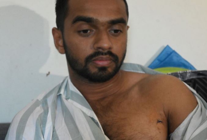 Syed Shadan is seen here with his shirt half on covering the wounds on his chest