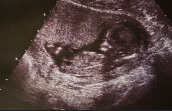 file photo of an ultrasound