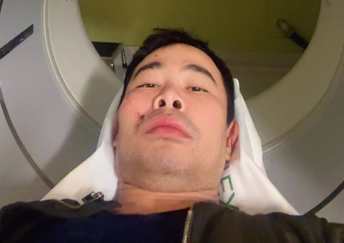 Pat Karaphat is seen underoing a CT scan after being attacked in the face